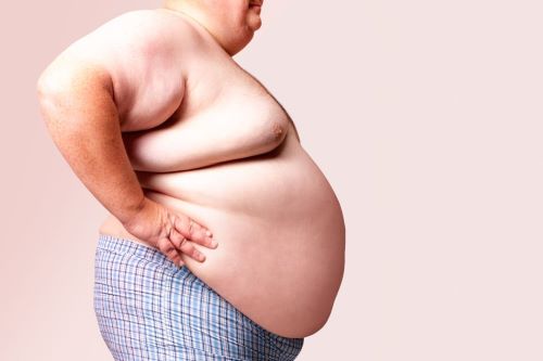 Esti obez? Afla cum te poti vindeca de aceasta boala